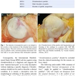 Sách Anterior Knee Pain And Patellar Instability, 3rd Edition