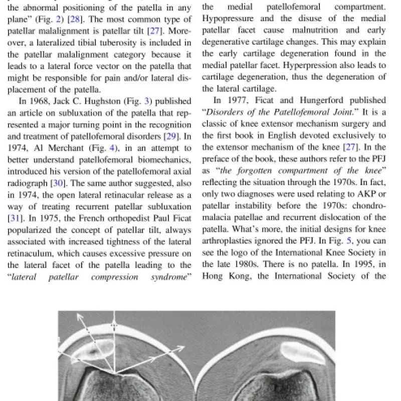 Sách Anterior Knee Pain And Patellar Instability, 3rd Edition