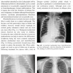 Sách Imaging in Pediatric Oncology