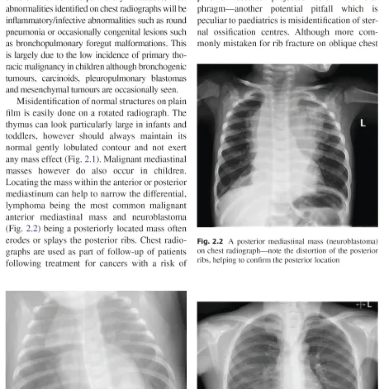 Sách Imaging in Pediatric Oncology
