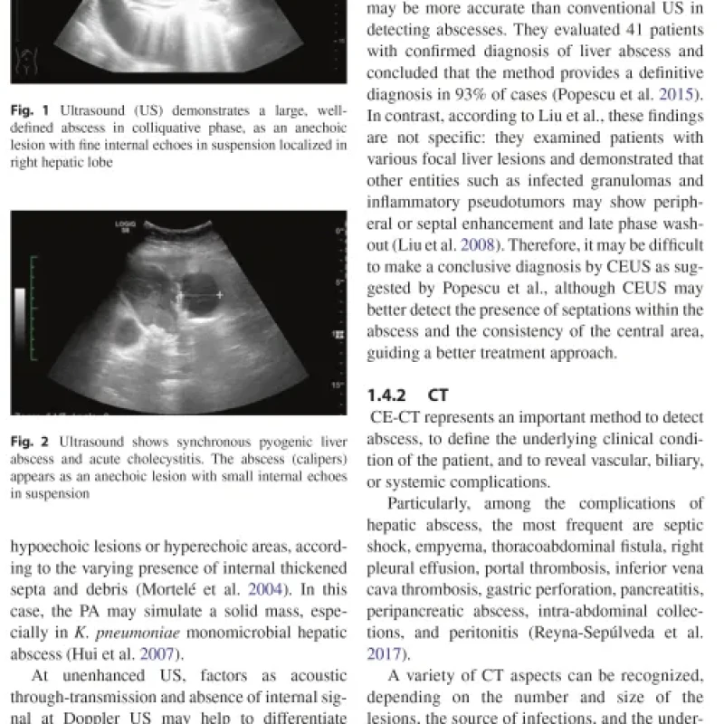 Sách Imaging of the Liver and Intra-hepatic Biliary Tract Volume 2