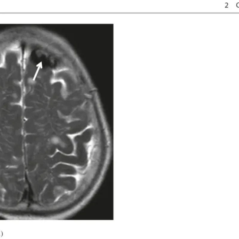 Sách Oncologic Imaging Bone Tumors